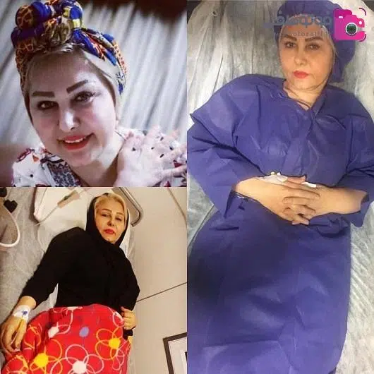 بیوگرافی زیبا مهرعلیزاده بازیگر سینما، تئاتر و تلویزیون + علت فوت