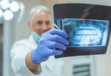 مزایای استفاده از Dental RVG چیست ؟