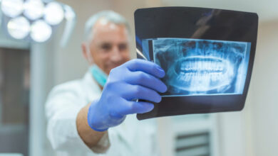 مزایای استفاده از Dental RVG چیست ؟