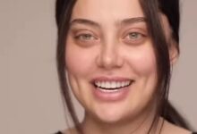 بیوگرافی آلارز