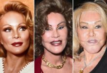 درگذشت جوسلین ویلدنشتاین ملقب به زن گربه ای 15 دی 1403 + علت فوت درگذشت جوسلین ویلدنشتاین