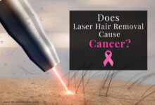 آیا لیزر موهای زائد باعث سرطان می‌شود؟