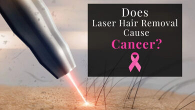 آیا لیزر موهای زائد باعث سرطان می‌شود؟