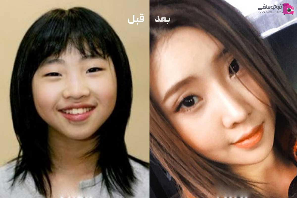 مینزی مینزی