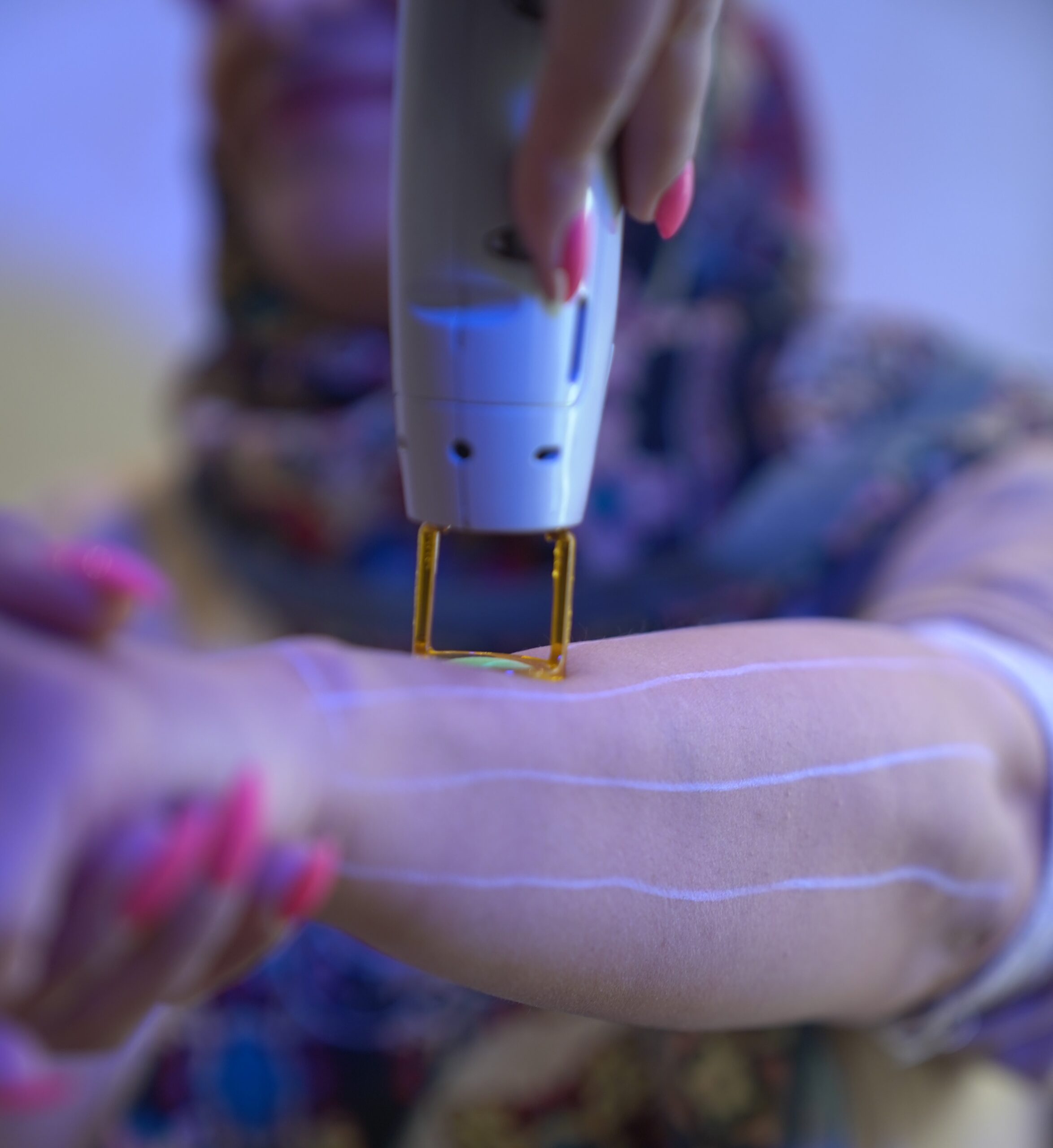 تفاوت کندلا اورجینال و تقلبی تفاوت کندلا اورجینال و تقلبی