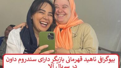بیوگرافی ناهید قهرمانی بازیگر دارای سندروم داون در سریال آلا بیوگرافی ناهید قهرمانی بازیگر دارای سندروم داون