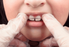 ارتودنسی کودکان درد دارد