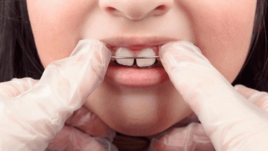 آیا ارتودنسی کودکان درد دارد؟ | پاسخ به نگرانی والدین ارتودنسی کودکان درد دارد